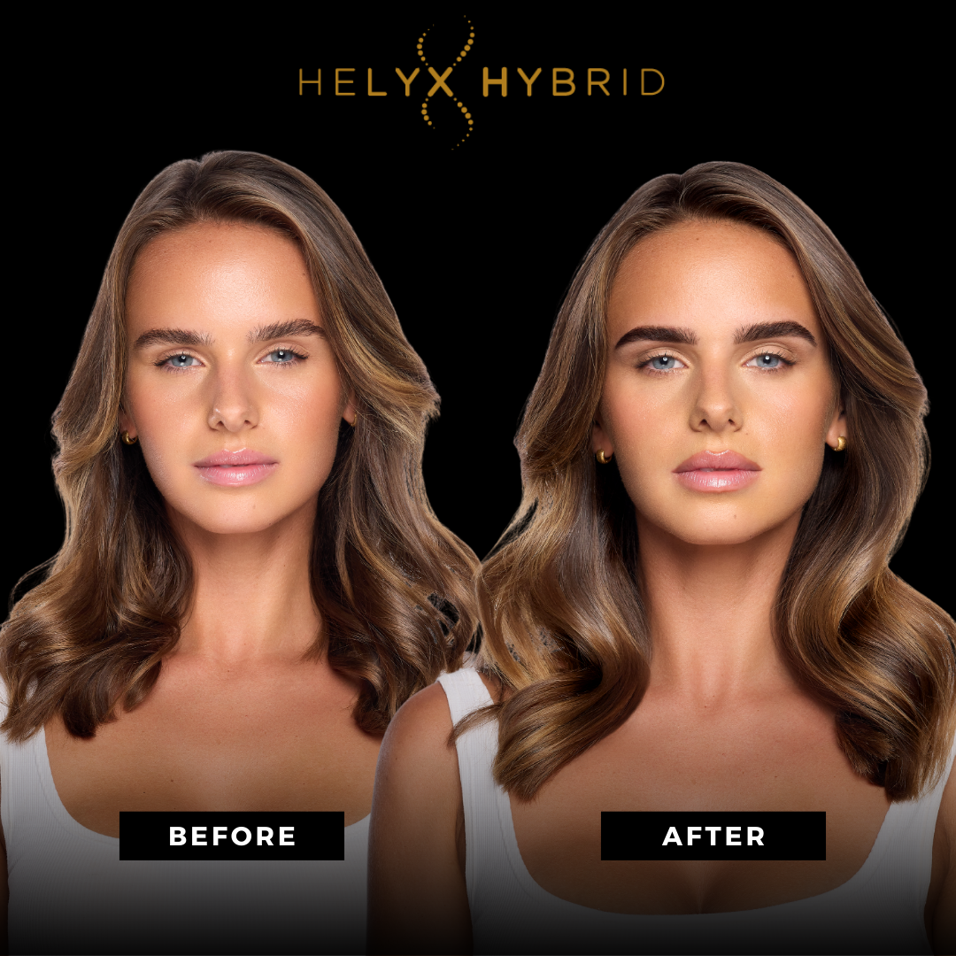Elleebana Helyx Hybride before and after